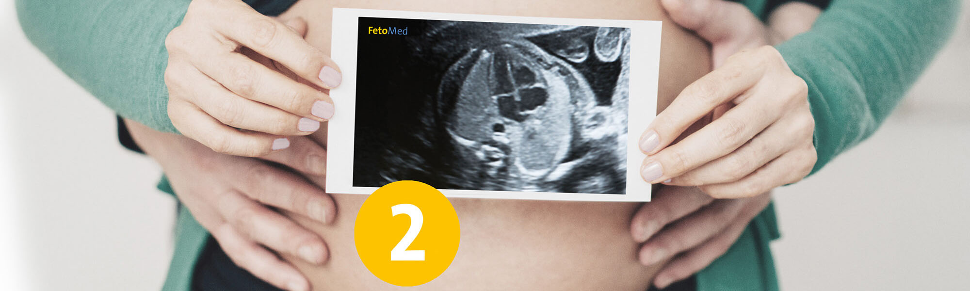 Ultraschall-Bild eines ungeborenen Kindes vor einem entblößten schwangeren Bauch.