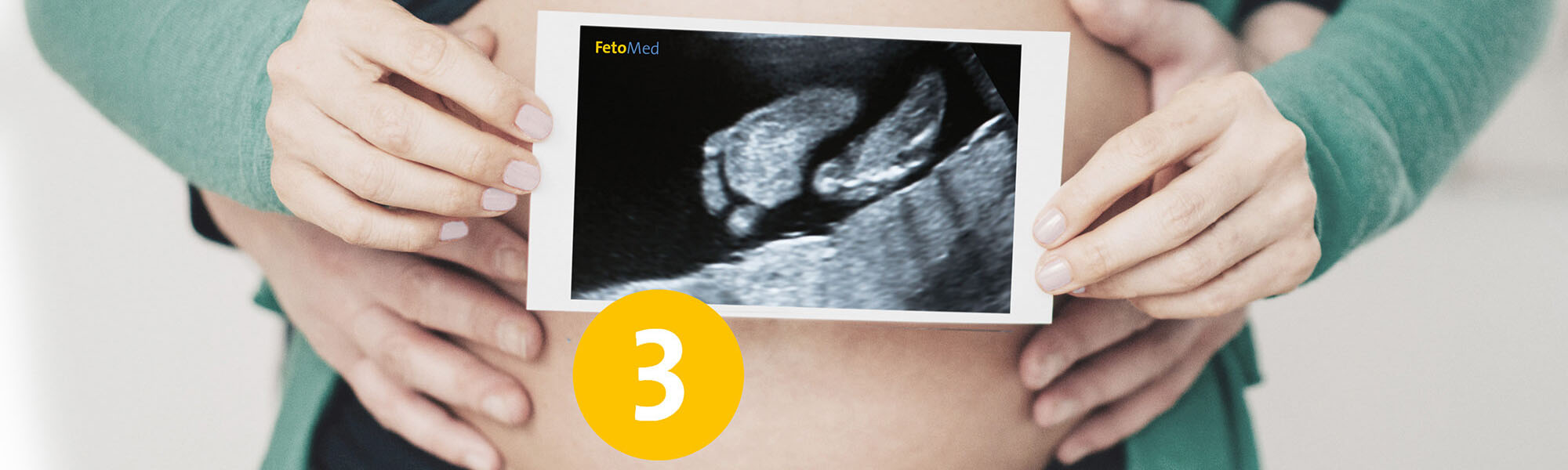 Ultraschall-Bild eines ungeborenen Kindes vor einem entblößten schwangeren Bauch.