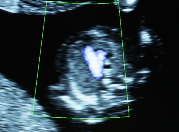 Schwarzweiß-Ultraschallbild des Herzens eines ungeborenen Kindes