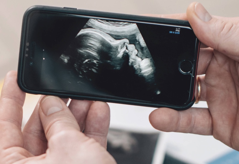 Smartphone auf dem ein Ultraschallbild eines ungeborenen Kindes zu sehen ist.